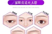 《双点医院》连眉怪打法攻略（打败连眉怪的绝招）