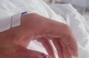 手指受伤如何继续玩王者荣耀？有哪些辅助工具？