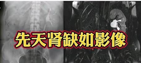 探究双点医院放射遗传技能在游戏中的应用效果（利用放射遗传技能优化游戏体验）