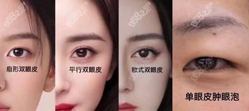 《怪物猎人世界》中双点医院的连眉怪击杀技巧介绍（掌握连眉怪的攻击方式）