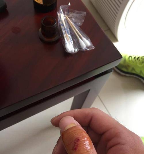 手指受伤如何继续玩王者荣耀？有哪些辅助工具？